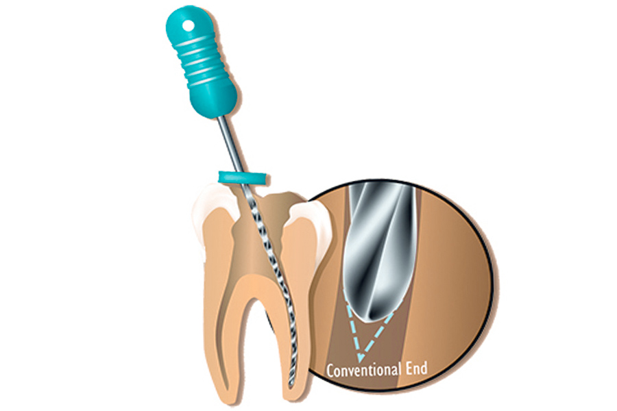 Reamer in dentistry