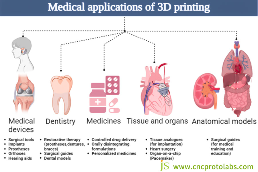 Aplicaciones biomédicas de la impresión 3D