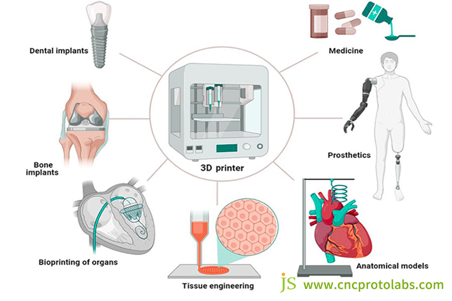Avances en la impresión 3D en la medicina