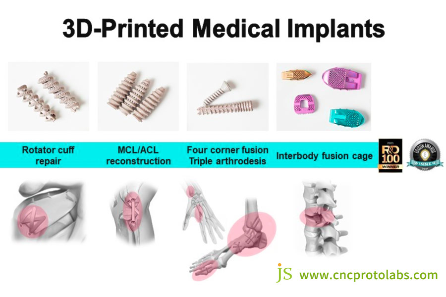 Impresión 3D de materiales y estructuras biomiméticas para la integración tisular